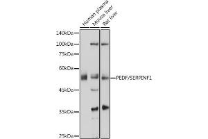 Western blot analysis of extracts of various cell lines, using PEDF/PEDF/SERPINF1 antibody (ABIN6131334, ABIN6147606, ABIN6147607 and ABIN6215471) at 1:1000 dilution.