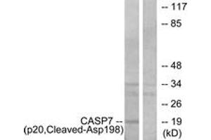 Western blot analysis of extracts from Jurkat cells, treated with etoposide 25uM 24h, using Caspase 7 (p20,Cleaved-Asp198) Antibody.