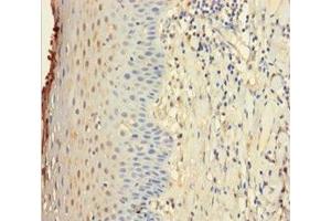 Immunohistochemistry of paraffin-embedded human tonsil tissue using ABIN7156855 at dilution of 1:100 (IL22 Receptor alpha 1 antibody  (AA 250-573))
