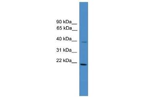 Western Blotting (WB) image for anti-DnaJ (Hsp40) Homolog, Subfamily B, Member 4 (DNAJB4) (Middle Region) antibody (ABIN2784855)