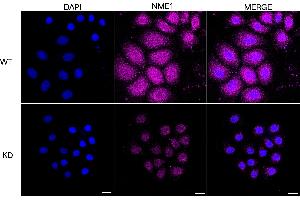 Immunocytochemical staining of HeLa cells using NME1 antibody (ABIN7799617), 1:1,000), Top panel: wild-type (WT), Bottom panal: NME1 shRNA knockdown (KD).