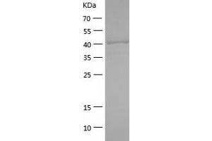 PLXDC1 Protein (AA 20-426) (His tag)