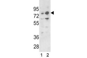 Western blot analysis of PLZF antibody and 1) 293 and 2) K562 lysate (ZBTB16 antibody  (AA 637-666))