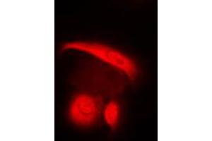 Immunofluorescent analysis of c-SRC staining in HuvEc cells. (Src antibody  (C-Term))
