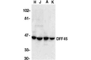 Western blot analysis of DFF45 in HeLa (H), Jurkat (J), A431 (A), and K562 (K) whole cell lysate with AP30289PU-N DFF45 antibody at 1/1000 dilution.
