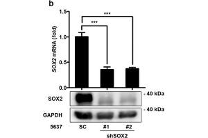 SOX2 mediates growth of bladder cancer cells. (SOX2 antibody)