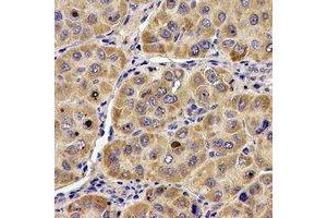 Immunohistochemical analysis of ANG staining in human liver formalin fixed paraffin embedded tissue section. (ANG antibody  (N-Term))