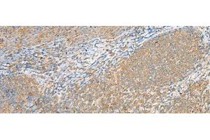 Immunohistochemistry of paraffin-embedded Human tonsil tissue using FOLR1 Polyclonal Antibody at dilution of 1:80(x200) (FOLR1 antibody)