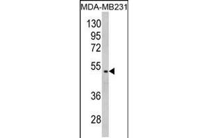 Western blot analysis of GALT Antibody in MDA-MB231 cell line lysates (35ug/lane) (GALT antibody  (C-Term))