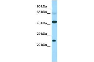 Host: Rabbit Target Name: CABS1 Sample Type: Fetal Heart lysates Antibody Dilution: 1.