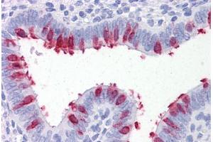 Human Uterus: Formalin-Fixed, Paraffin-Embedded (FFPE) (ARVCF antibody  (AA 863-963))