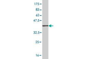 Western Blot detection against Immunogen (36. (RASGRP2 antibody  (AA 65-164))