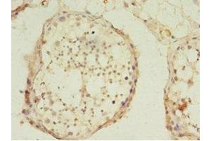 Immunohistochemistry of paraffin-embedded human testis tissue using ABIN7174332 at dilution of 1:100 (USP45 antibody  (C-Term))