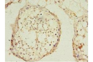 Immunohistochemistry of paraffin-embedded human testis tissue using ABIN7174332 at dilution of 1:100