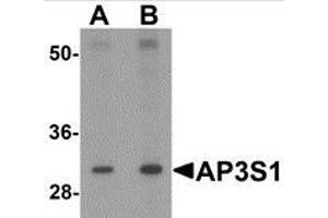 Western blot analysis of AP3S1 in mouse kidney tissue lysate with AP3S1 antibody at (A) 1 and (B) 2 μg/ml. (AP3S1 antibody  (Center))
