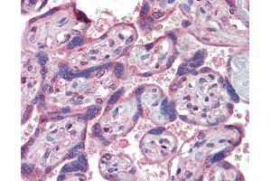 Anti-IFNAR2 antibody IHC of human placenta. (IFNAR2 antibody  (AA 28-40))
