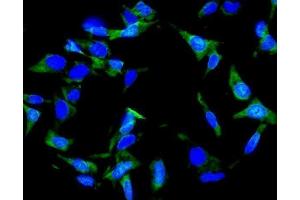 IF analysis of Inhibin alpha/INHA using anti-Inhibin alpha/INHA antibody (ABIN7600932). (Inhibin alpha antibody  (AA 254-366))