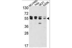 Western blot analysis of IMPDH2 Antibody (Center) in NCI-H460,Hela,MCF7,A2058 cell line lysates(35ug/lane).