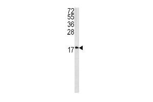 Western blot analysis of CAV3 antibody (N-term) (ABIN390412 and ABIN2840801) in 293 cell line lysates (35 μg/lane). (Caveolin 3 antibody  (N-Term))