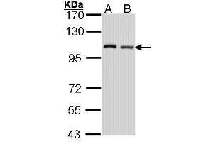 WB Image Sample (30 ug of whole cell lysate) A: Hela B: Hep G2 , 7. (EIF4G2 antibody  (C-Term))