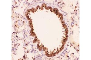 IHC-P: Annexin A1 antibody testing of rat lung tissue (Annexin a1 antibody  (AA 2-346))