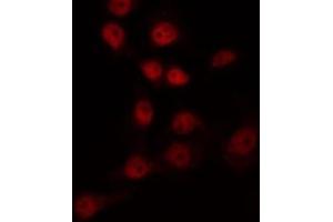 ABIN6266966 staining COS7 by IF/ICC. (FOXL1 antibody)