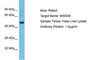Host: Rabbit Target Name: SHISA9 Sample Type: Fetal Liver lysates Antibody Dilution: 1. (Shisa9 antibody  (Middle Region))