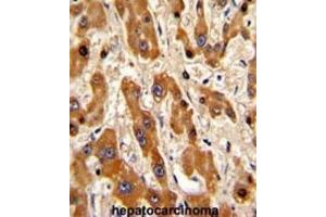 Immunohistochemistry (IHC) image for anti-BCL2-Associated X Protein (BAX) (BH3 Domain) antibody (ABIN2995215)