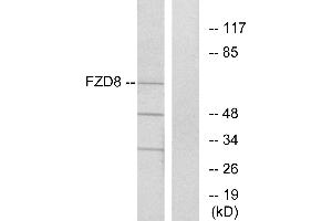 Western blot analysis of extracts from Jurkat cells, using FZD8 antibody. (FZD8 antibody  (Internal Region))