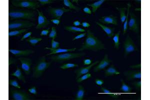 Immunofluorescence of monoclonal antibody to AKAP9 on HeLa cell. (AKAP9 antibody  (AA 3812-3911))