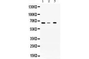 Western blot analysis of WDR1 expression in rat liver extract ( Lane 1), mouse brain extract ( Lane 2) and A431 whole cell lysates ( Lane 3). (WDR1 antibody  (C-Term))