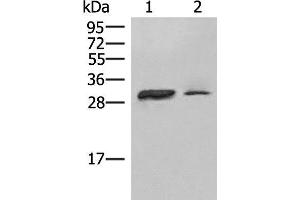 Western blot analysis of Raji cell Human spleen tissue lysates using HLA-DPA1 Polyclonal Antibody at dilution of 1:400 (HLA-DPA1 antibody)
