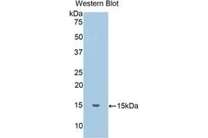Detection of Recombinant Haptoglobin, Human using Polyclonal Antibody to Haptoglobin (Hpt) (Haptoglobin antibody  (AA 44-157))