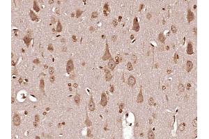 Paraformaldehyde-fixed, paraffin embedded Rat brain Antigen retrieval by boiling in sodium citrate buffer (pH6. (MT-ND6 antibody  (AA 51-150))