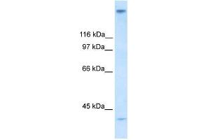 Human Stomach; WB Suggested Anti-ZNF318 Antibody Titration: 0. (ZNF318 antibody  (N-Term))