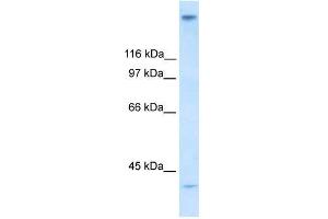 Human Stomach; WB Suggested Anti-ZNF318 Antibody Titration: 0.
