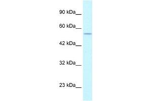 WB Suggested Anti-EGLN1 Antibody Titration:  1. (EGLN1 antibody  (C-Term))