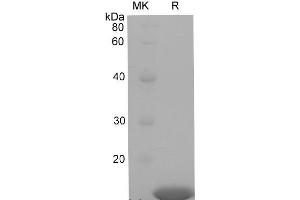 Western Blotting (WB) image for Retinol Binding Protein 1, Cellular (RBP1) protein (His tag) (ABIN7320881) (RBP1 Protein (His tag))