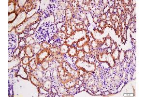 Formalin-fixed and paraffin embedded rat kidney labeled with Anti-TNFRSF13B Polyclonal Antibody, Unconjugated  at 1:200 followed by conjugation to the secondary antibody and DAB staining. (TACI antibody  (AA 21-120))