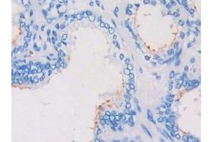 Detection of CRKL in Human Prostate Tissue using Polyclonal Antibody to Crk Like Protein (CRKL) (CrkL antibody  (AA 1-303))