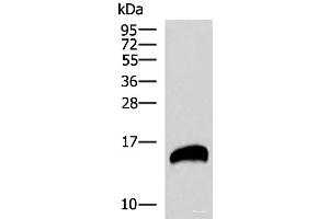 Western blot analysis of Human pancreas tissues lysate using REG1B Polyclonal Antibody at dilution of 1:800
