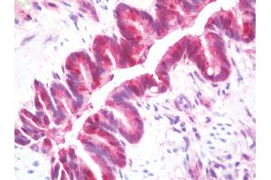 Anti-GSTT1 antibody IHC staining of human lung. (GSTT1 antibody  (AA 1-240))