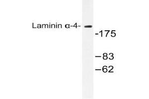 Western blot (WB) analysis of Laminin alpha-4 antibody in extracts from COLO cells.
