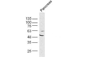 Mouse pancreas lysates probed with AKT1/3 Polyclonal Antibody, unconjugated  at 1:300 overnight at 4°C followed by a conjugated secondary antibody at 1:10000 for 90 minutes at 37°C. (AKT1/3 (AA 401-479) antibody)
