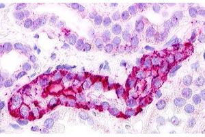 Image no. 1 for anti-G Protein-Coupled Receptor, Family C, Group 5, Member D (GPRC5D) (Extracellular Domain) antibody (ABIN1048919) (GPRC5D antibody  (Extracellular Domain))