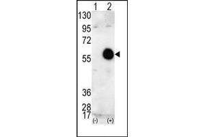 Western blot analysis of AKT2 (arrow) using AKT2 Antibody (AKT2 antibody  (C-Term))