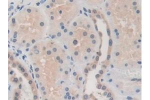 Detection of MMP19 in Human Kidney Tissue using Polyclonal Antibody to Matrix Metalloproteinase 19 (MMP19) (MMP19 antibody  (AA 98-508))