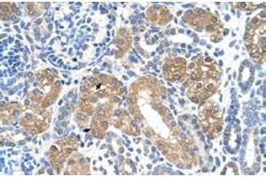 Immunohistochemical staining (Formalin-fixed paraffin-embedded sections) of human kidney with FAH polyclonal antibody  at 4-8 ug/mL working concentration. (FAH antibody  (C-Term))