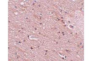 Immunohistochemical staining of human brain tissue with 5 ug/mL ANO2 polyclonal antibody .