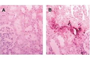 Immunohistochemistry image of CRA-modified protein staining in paraffn sections of rat kidney exposed to ferric nitrilotriacetate. (Crotonaldehyde (CRA) antibody)